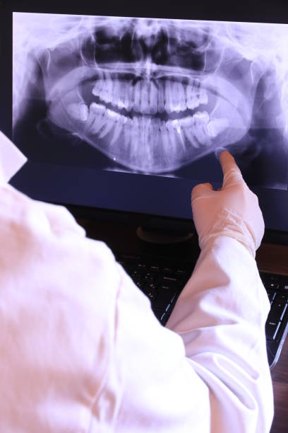 Best Emergency Tooth Extraction in South Williamsport, PA